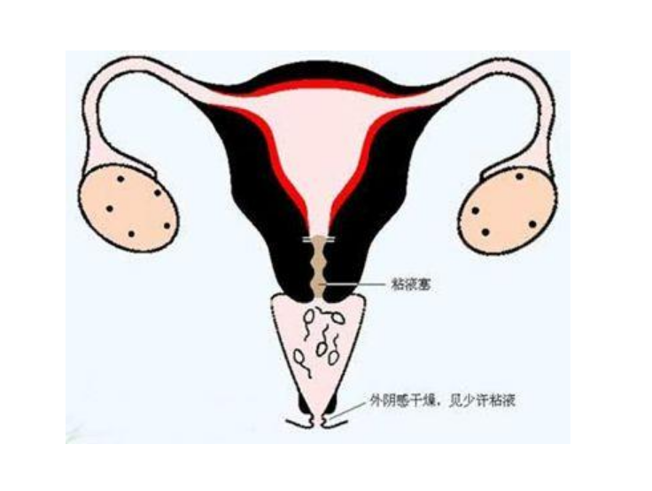 输卵管畸形是否适合试管婴儿？