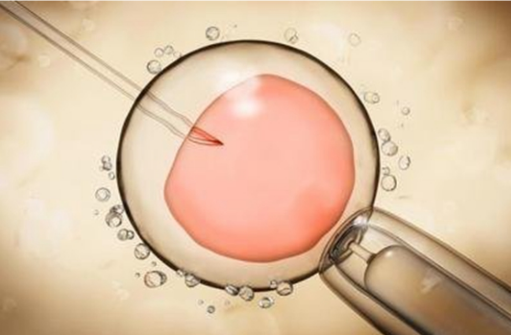 进行试管婴儿胚胎移植手术会特别痛吗？